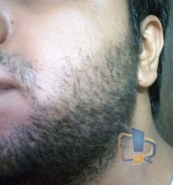 No Shave for 2 weeks